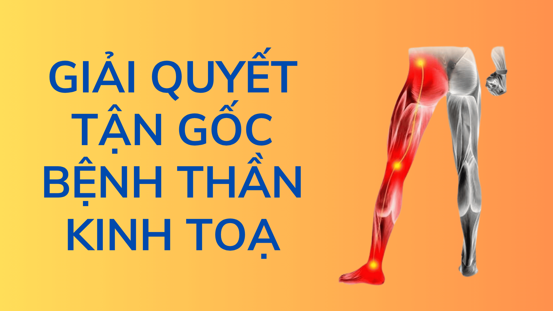 ĐAU THẦN KINH TOẠ - NGUYÊN NHÂN, CƠ CHẾ VÀ GIẢI PHÁP TẬN GỐC