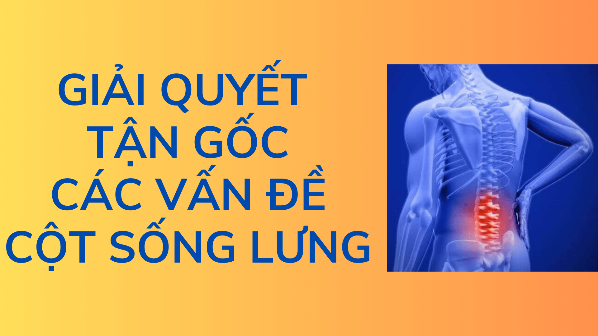 GIẢI QUYẾT TẬN GỐC CÁC VẤN ĐỀ CỘT SỐNG LƯNG