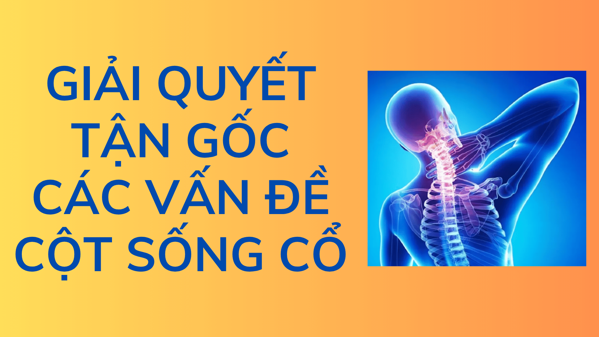 GIẢI QUYẾT TẬN GỐC VẤN ĐỀ CỘT SỐNG CỔ